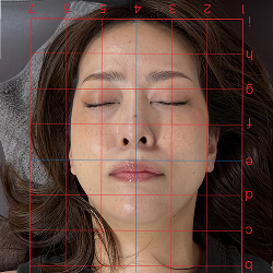 美容鍼の施術前