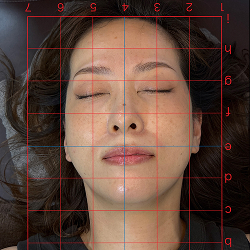 美容鍼の施術後