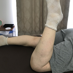 手技療法の施術後